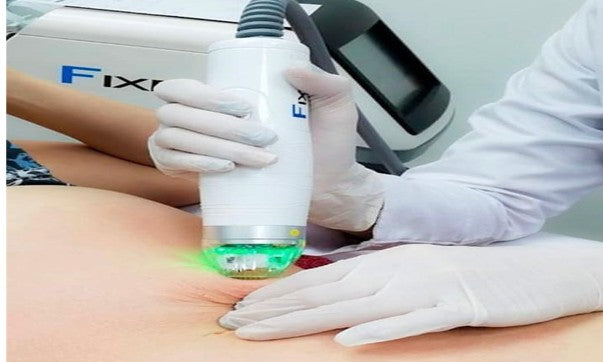 Fixer Corporal (Radiofrecuencia Fraccionada) Precio por 3 sesiones