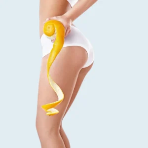Tratamiento anticelulitis, clínica estética high care beauty en Antofagasta.