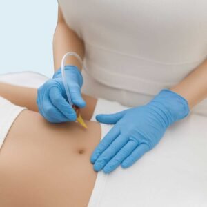 carboxiterapia, clínica estética high care beauty en Antofagasta.