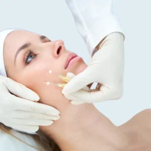 Hilos tensores y revitalizantes, clínica estética high care beauty en Antofagasta.