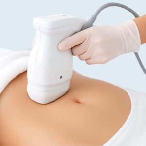 Hifu corporal, clínica estética high care beauty en Antofagasta.